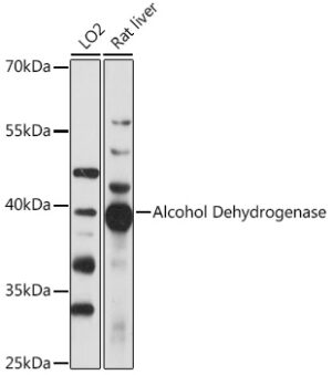 Alcohol Dehydrogenase Rabbit pAb