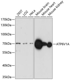 ATP6V1A Rabbit pAb