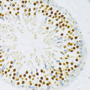 DP1/TFDP1 Rabbit pAb