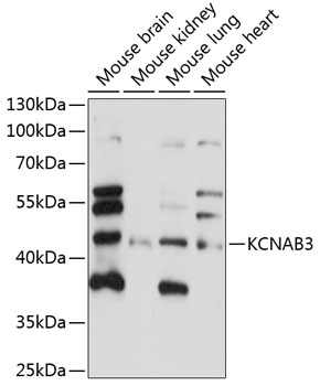 KCNAB3 Rabbit pAb
