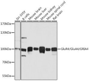 GluR4/GluA4/GRIA4 Rabbit pAb