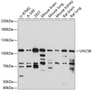 UNC5B Rabbit pAb