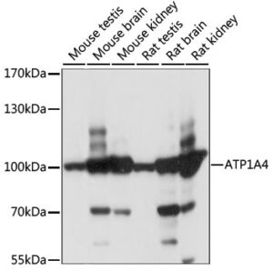 ATP1A4 Rabbit pAb