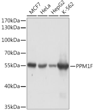 PPM1F Rabbit pAb