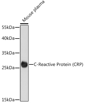 C-Reactive Protein (CRP) Rabbit pAb