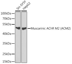 Muscarinic AChR M2 (ACM2) Rabbit pAb