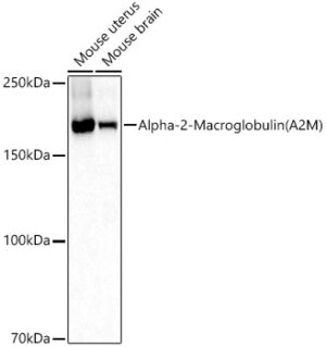 Alpha-2-Macroglobulin (A2M) Rabbit pAb