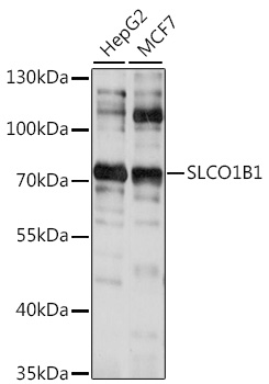 SLCO1B1 Rabbit pAb