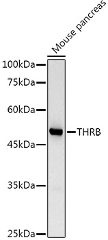 TRβ1/THRB Rabbit pAb