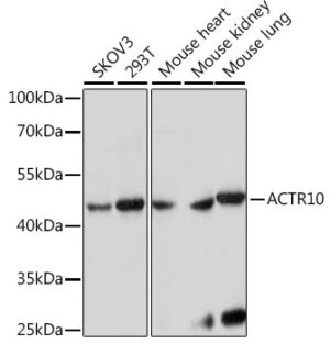 ACTR10 Rabbit pAb