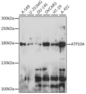 ATP10A Rabbit pAb