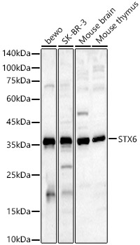 STX6 Rabbit pAb