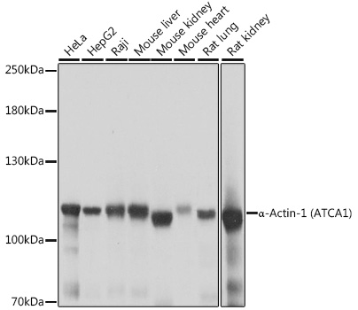 α-Actinin-4 Rabbit pAb
