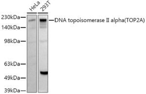 DNA topoisomerase II alpha (TOP2A) Rabbit pAb
