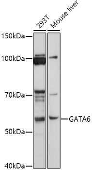 GATA6 Rabbit pAb