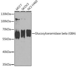 Glucosylceramidase beta (GBA) Rabbit pAb