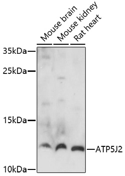 ATP5J2 Rabbit pAb