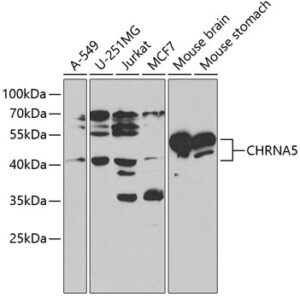 CHRNA5 Rabbit pAb