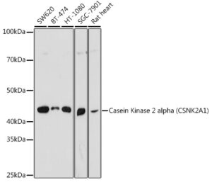 Casein Kinase 2 alpha (CSNK2A1) Rabbit pAb