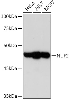 NUF2 Rabbit mAb