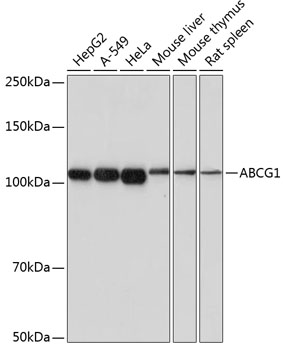 ABCG1 Rabbit mAb