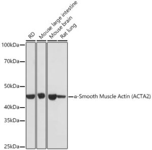 α-Smooth Muscle Actin (ACTA2) Rabbit mAb