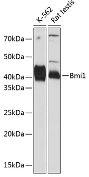 Bmi1 Rabbit mAb