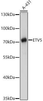 ETV5 Rabbit pAb