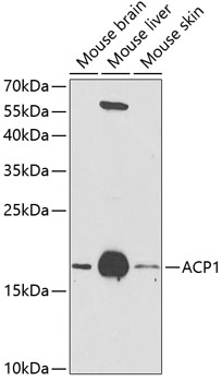 ACP1 Rabbit pAb