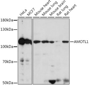 AMOTL1 Rabbit pAb