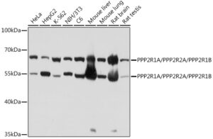 PPP2R1A/PPP2R2A/PPP2R1B Rabbit pAb
