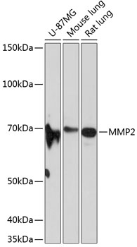 MMP2 Rabbit mAb