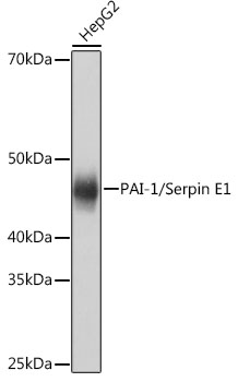 PAI-1/Serpin E1 Rabbit mAb