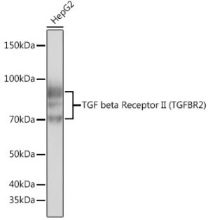TGF beta Receptor II Rabbit mAb