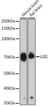 LGI1 Rabbit mAb