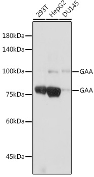 GAA Rabbit mAb