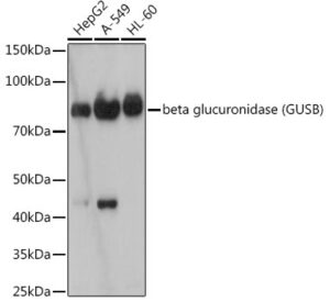 beta glucuronidase (GUSB) Rabbit mAb