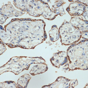 Placental lactogen (CSH1) Rabbit mAb