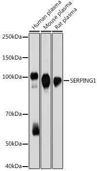 SERPING1 Rabbit mAb