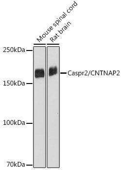 Caspr2/CNTNAP2 Rabbit mAb