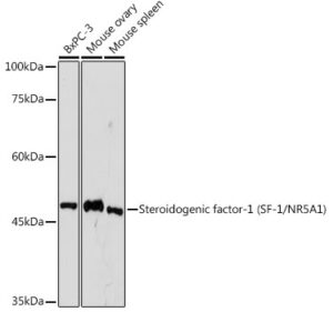 Steroidogenic factor-1 (SF-1/NR5A1) Rabbit mAb