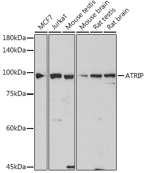 ATRIP Rabbit mAb