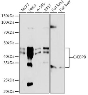 C/EBPB Rabbit mAb
