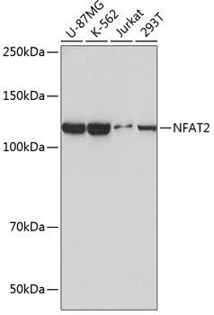 NFAT2 Rabbit mAb