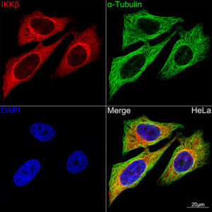 IKKβ Rabbit mAb