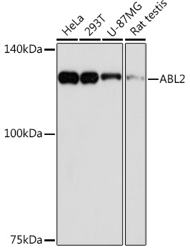 ABL2 Rabbit mAb