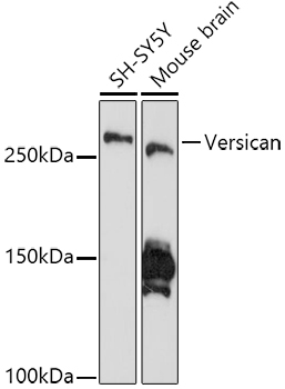 Versican Rabbit mAb