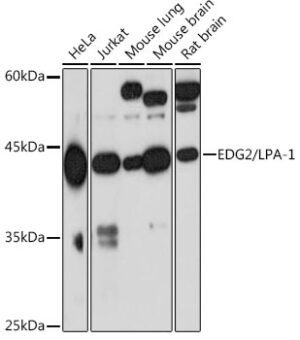 EDG2/LPA-1 Rabbit mAb