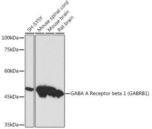 GABA A Receptor beta 1 (GABRB1) Rabbit mAb