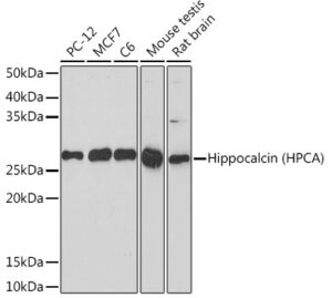 Hippocalcin (HPCA) Rabbit mAb